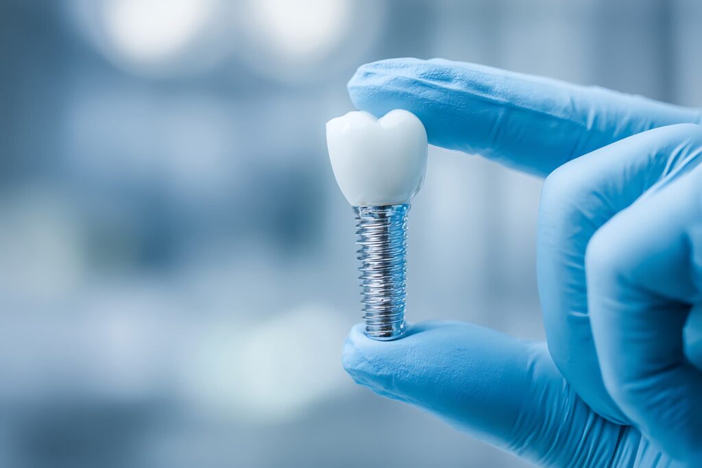 インプラント治療をする歯科医師